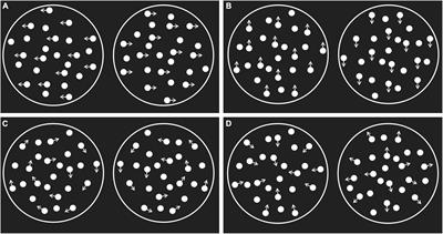 The possible positive effects of physical exercise on the global motion perception aging: the cognitive mechanism